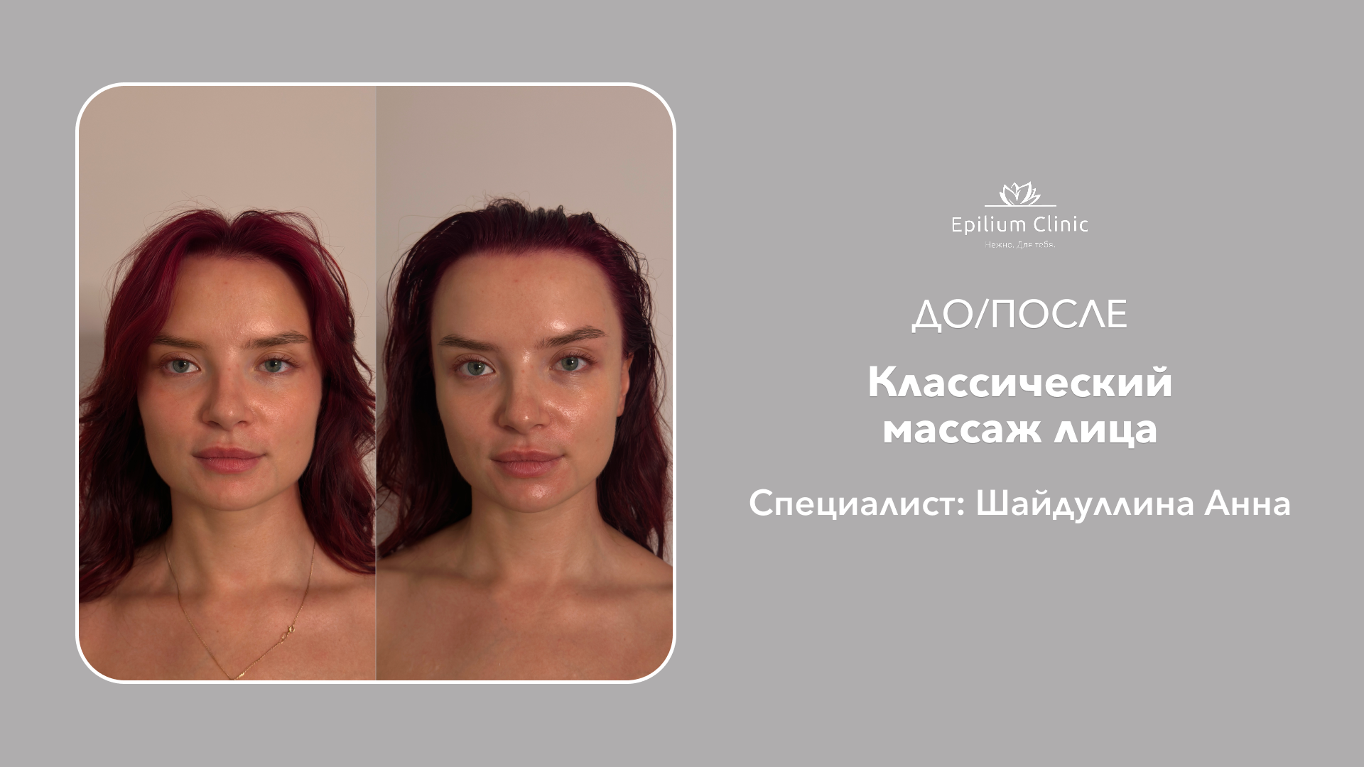 3_массаж_лица_Шайдуллина